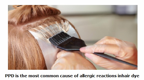 What You Should Know About Hair Dye Allergies Feminine Touch